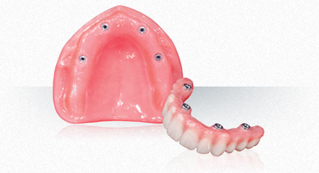 Hybryd Denture