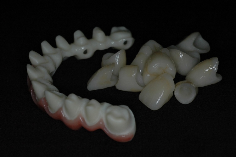 Zirconia Substructure with Individual Crownes